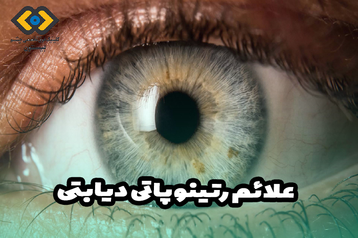 علائم رتینوپاتی دیابتی